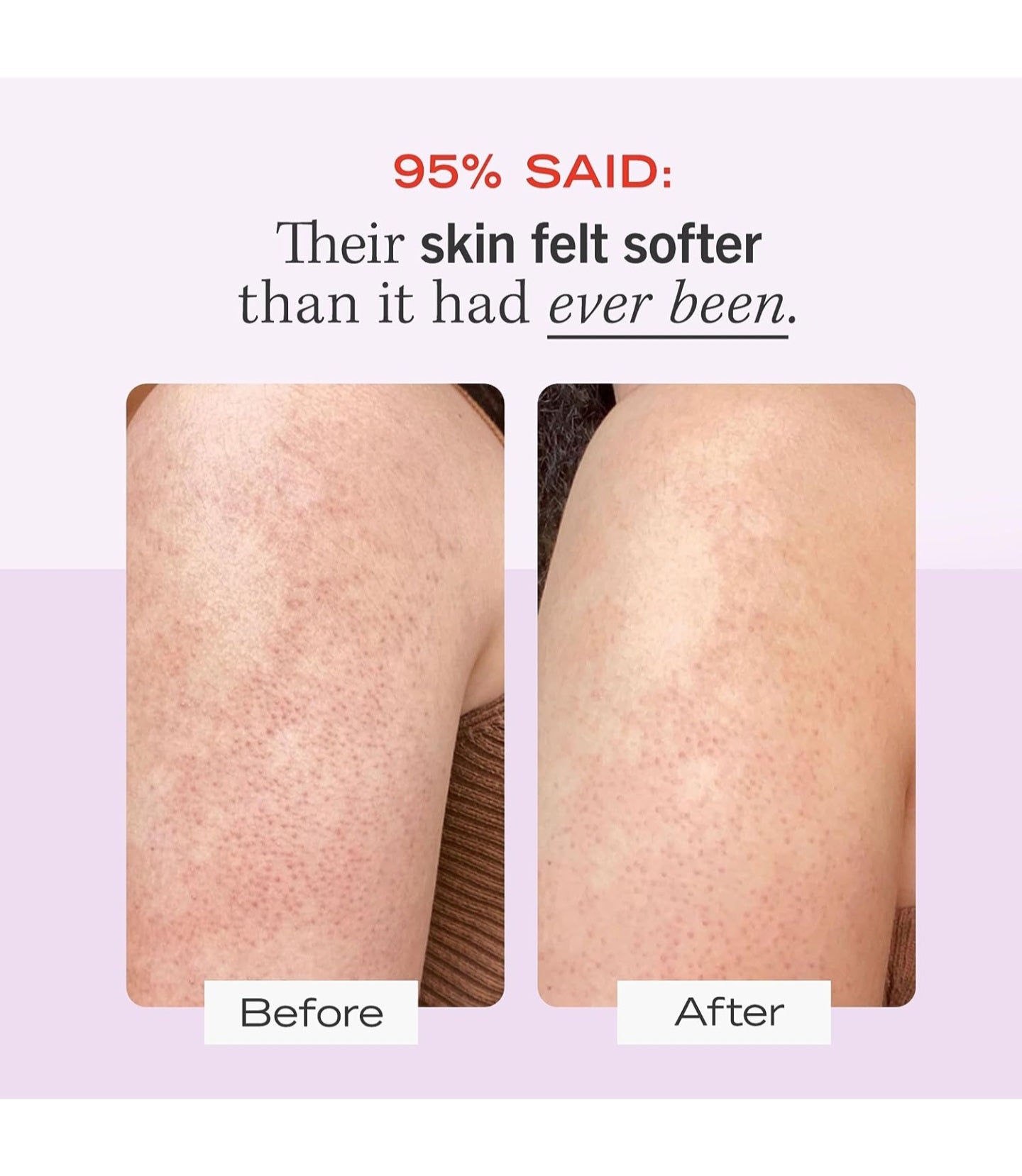 First Aid Beauty
KP Bump Eraser Body Scrub with 10% AHA